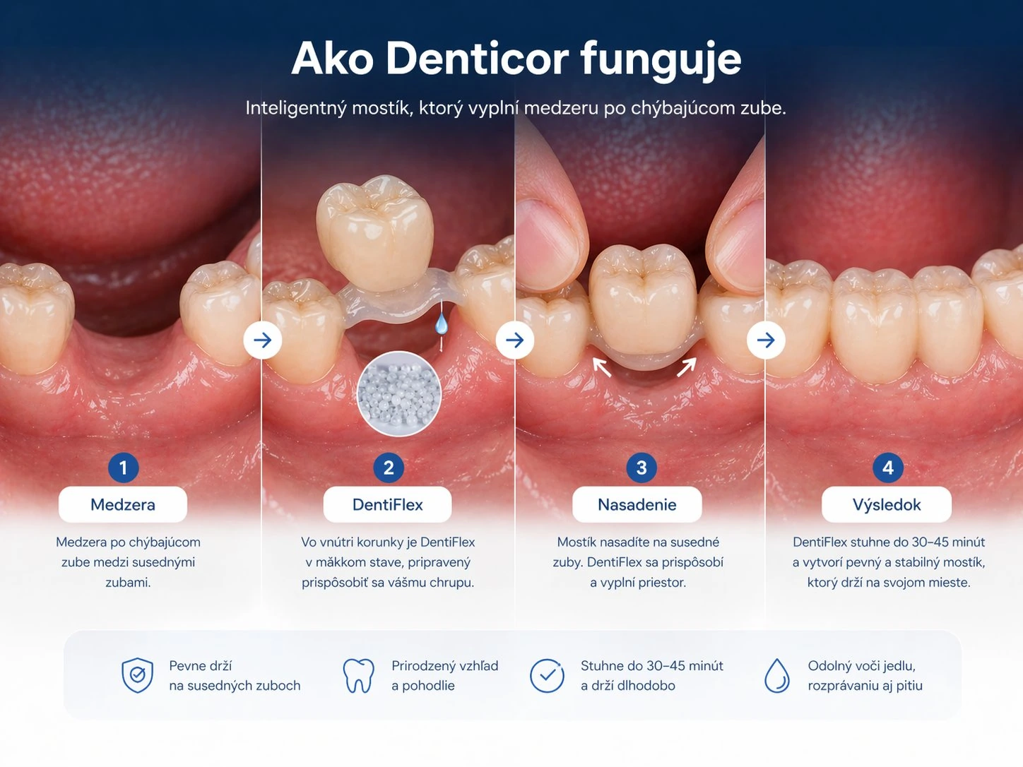 Cómo funciona Denticor cuando faltan tres dientes frontales superiores