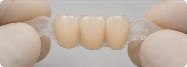 Guía visual: diente superior y premolar ausentes