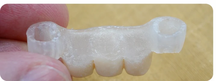 Demostración de la colocación de Denticor para un canino inferior y dos premolares: colocación del sustituto y modelado de su soporte contra los dientes vecinos