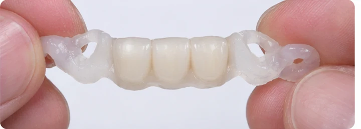 Guía visual: falta de tres dientes frontales superiores