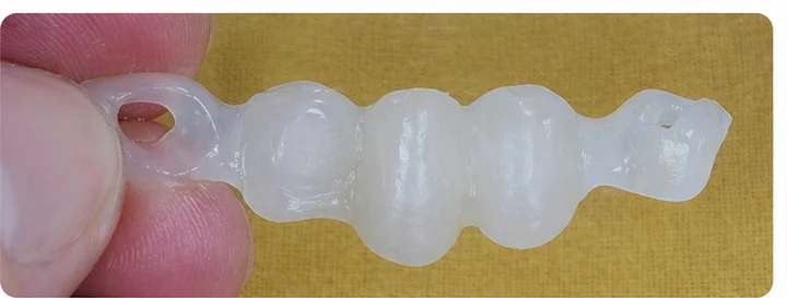 Procedimiento visual para dos premolares y una muela superiores: principio de colocación del puente Denticor con los nuevos dientes y su ajuste a los dientes adyacentes