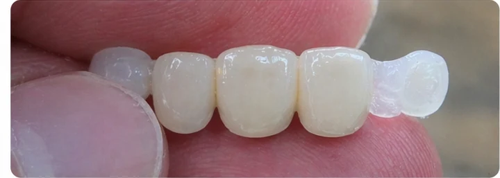 Demostración de ajuste del Denticor: colocación del recambio y modelado de su soporte DentiFlex · 3