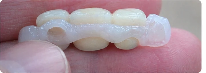Demostración de ajuste del Denticor: colocación del recambio y modelado de su soporte DentiFlex · 4