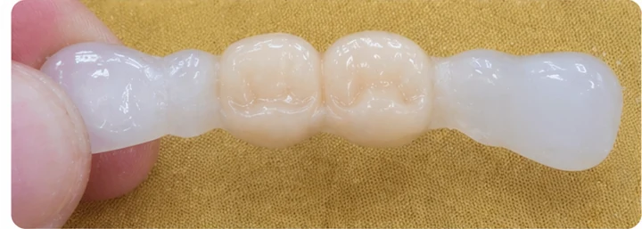 Demostración de ajuste del Denticor: colocación del recambio y modelado de su soporte DentiFlex · 3