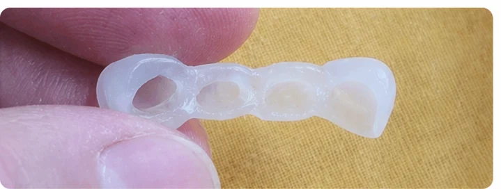 Procedimiento visual para tres dientes adyacentes en el arco superior: principio de colocación del puente Denticor con los nuevos dientes y su ajuste a los dientes circundantes