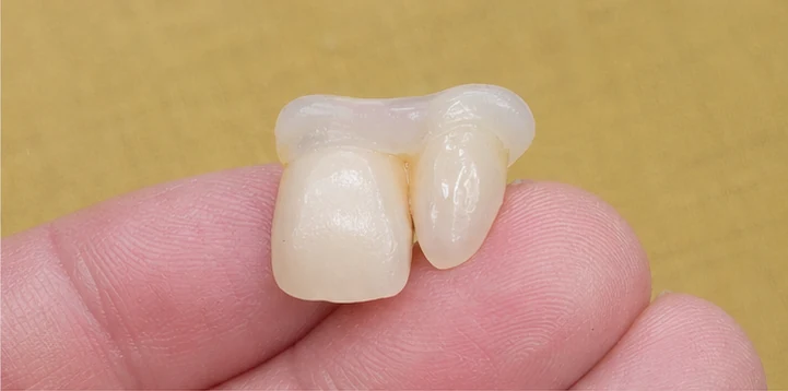 Procedimiento visual para la colocación y el ajuste de la prótesis: premolar inferior