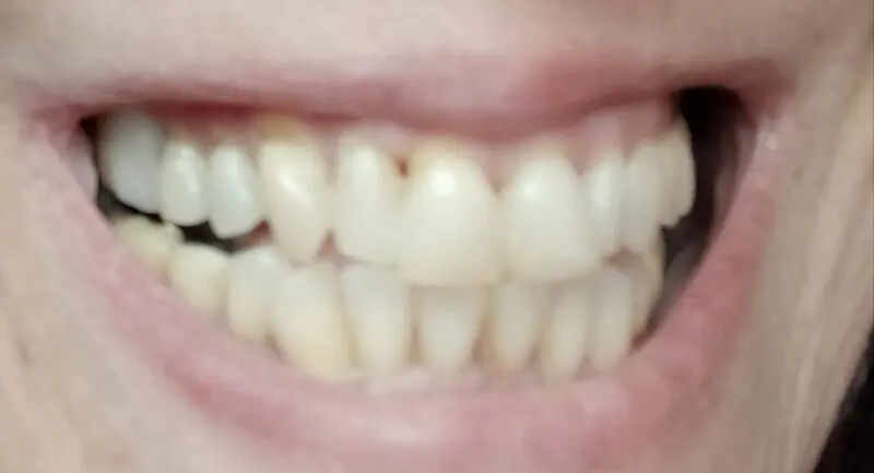 Cliente: espacio cubierto con Denticor